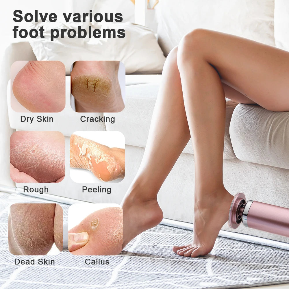 Electric Callus Remover