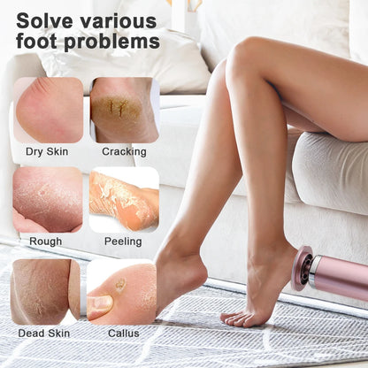 Electric Callus Remover